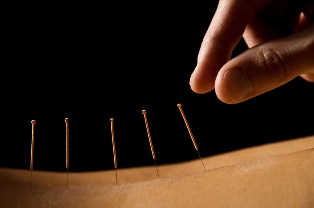 akupunktúra prosztatagyulladásra