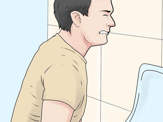 A fájdalmas vizelés a férfiaknál a prosztatagyulladás súlyosbodásának tünete